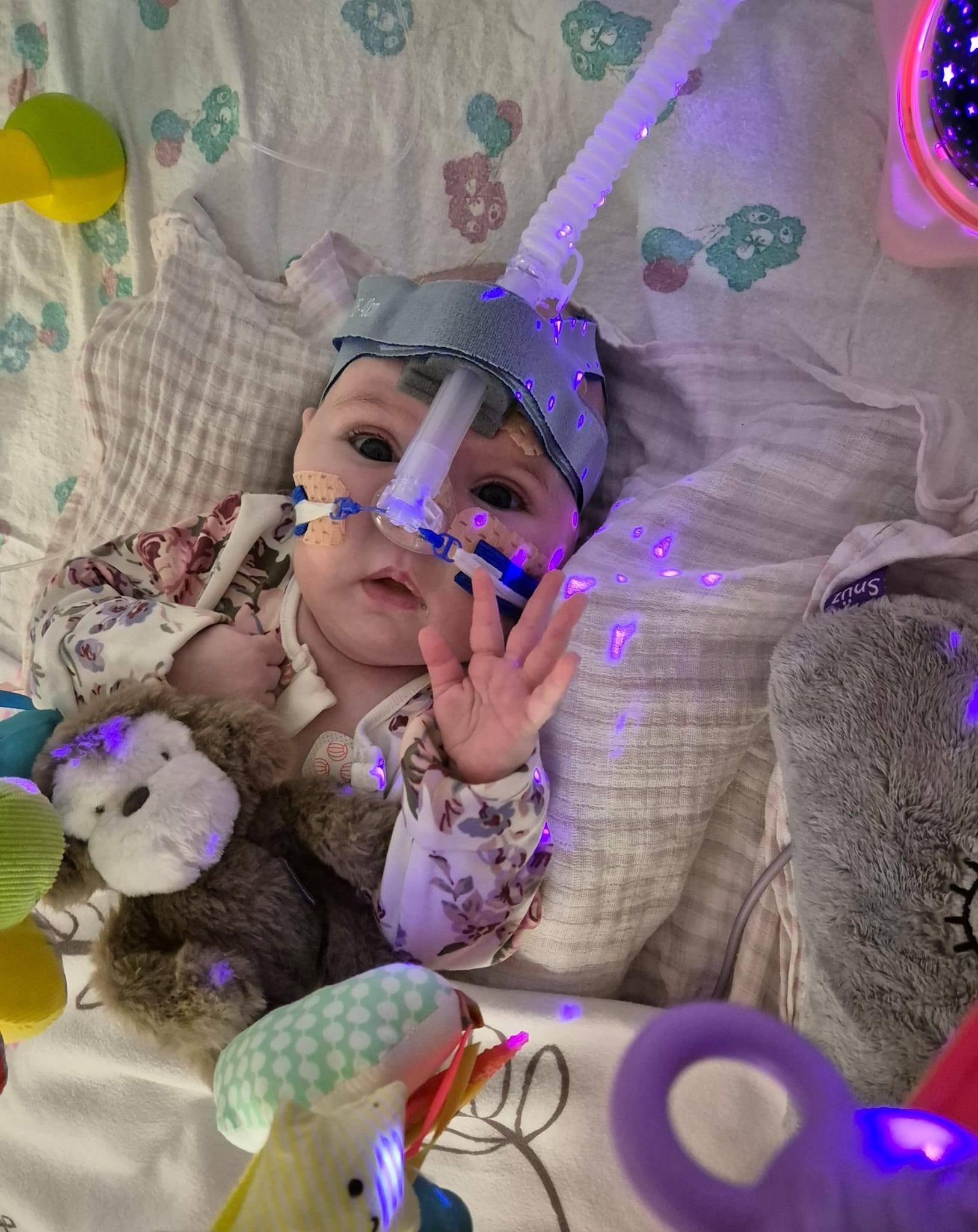 Baby Millie spent six months in hospital, undergoing heart surgery less than a month after being admitted.