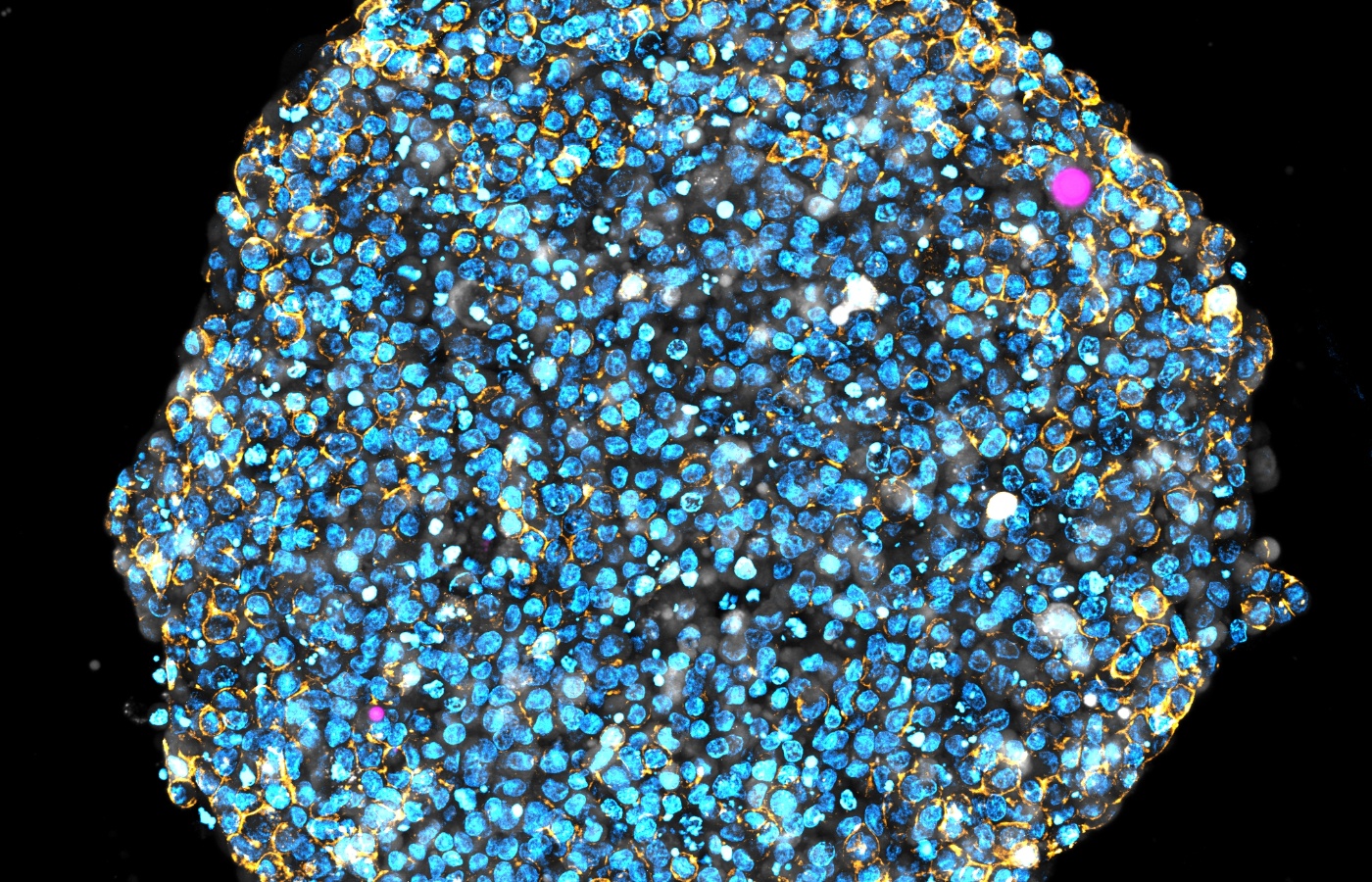 The microlasers, visible here as pink dots in a tumour spheroid, change colour when ‘squished and deformed by the cells around them’ (Gather and Schubert/PA). 