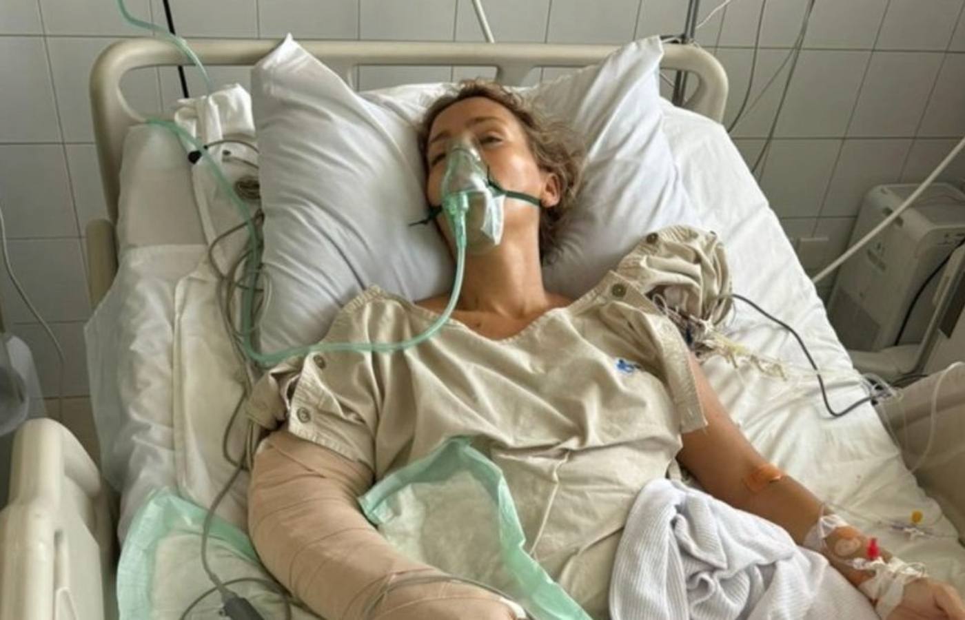 Charlene Morrissey faced a battle to save her arm after Bali scooter crash.