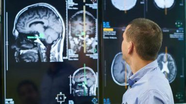 Edinburgh and Dundee experts in bid to develop tool to predict dementia risk