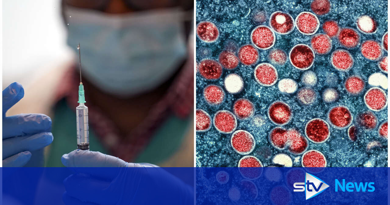 What is mpox, how does it spread - and is there a vaccine? | STV News