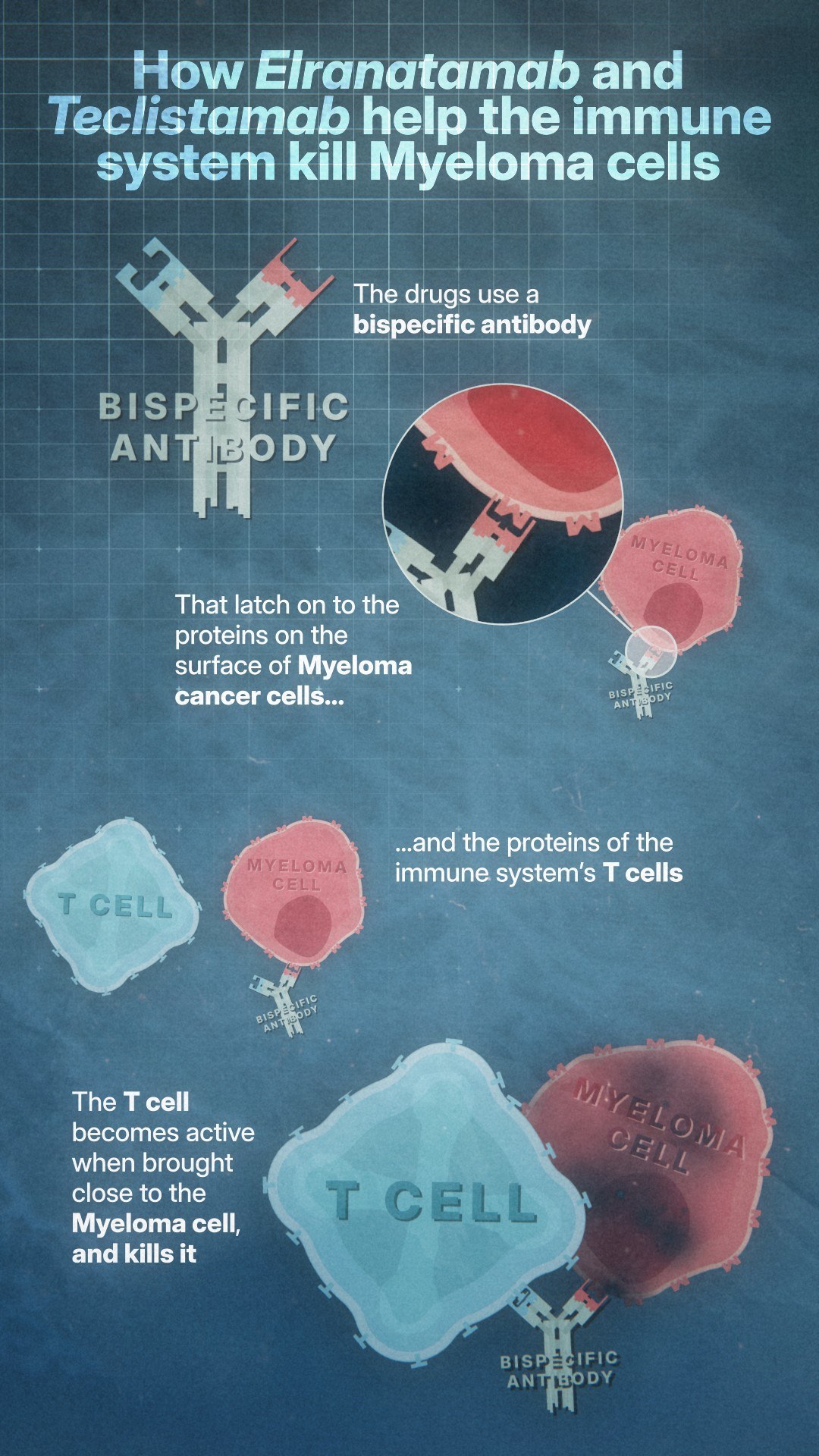 How new ground-breaking treatment works to tackle myeloma