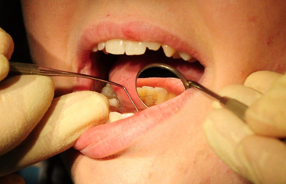 Just nine dental practices given funding from initiative in past four years