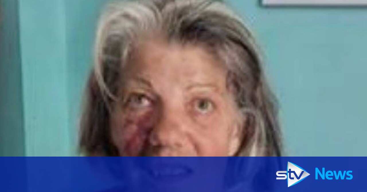 Police Extremely Concerned About Welfare Of Missing Woman Stv News Police Extremely Concerned About Welfare Of Missing Woman Stv News