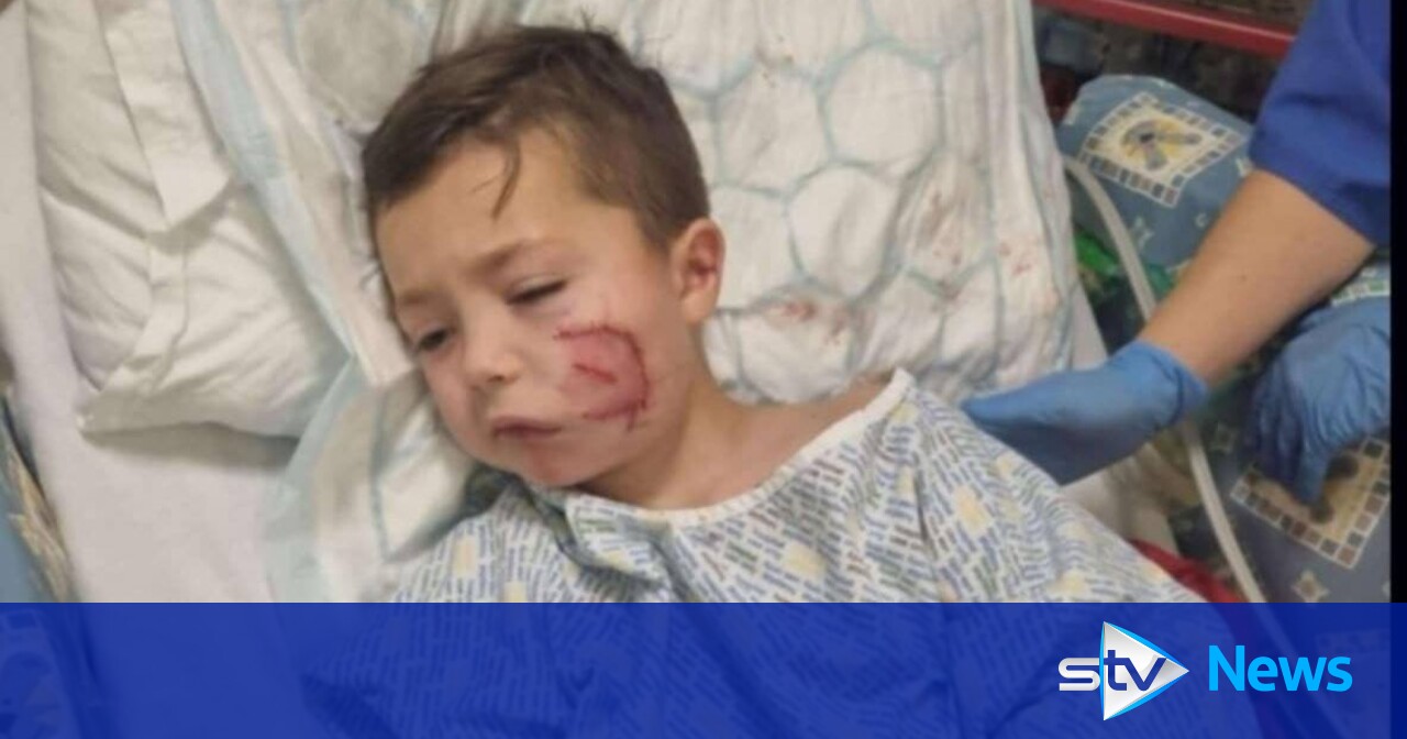 Paisley schoolboy scarred for life by XL Bully gifted tickets to first ...