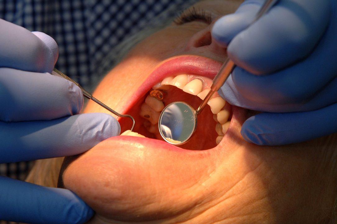 People from poorer areas less likely to see dentists, figures show