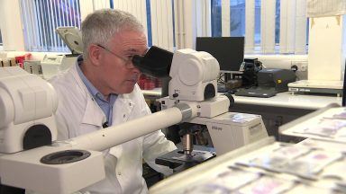 Scientist’s daughters keep family tradition alive as George King retires from post at Aberdeen Royal Infirmary