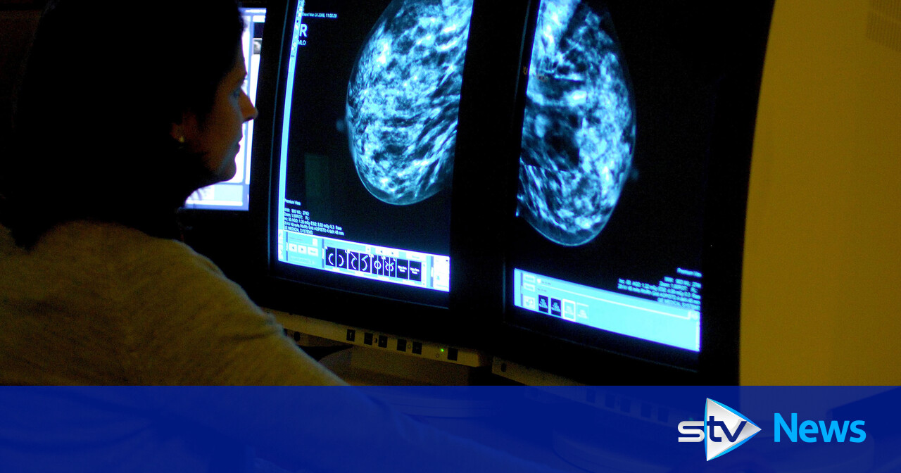New blood test can spot breast cancer at earliest stages, say ...