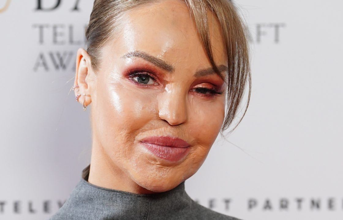 TV presenter Katie Piper trying out an ‘artificial eye’ 16 years on from acid attack