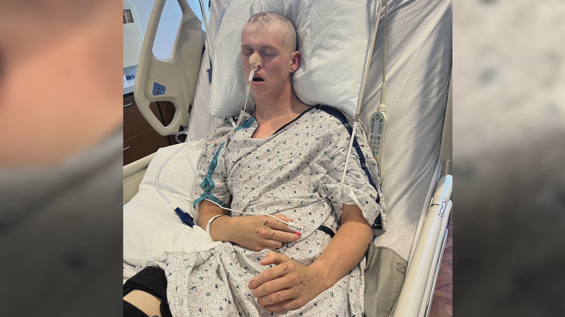 Ethan was in intensive care for six weeks following the crash