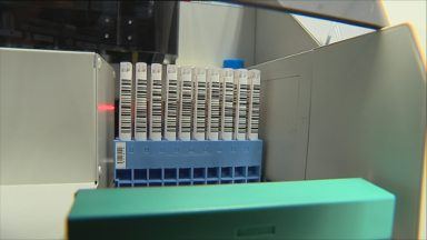 Call for bowel cancer testing age to be lowered