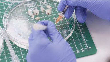 Major breakthrough in fight against Alzheimer’s, say Scots scientists