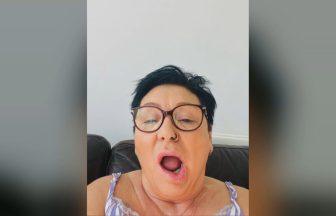 ‘I thought I was having a stroke after I got Botox – my face was drooping’