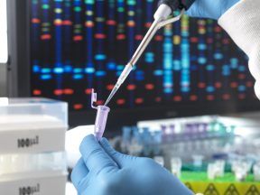 Women with genetic cancer risk being ‘missed’ due to testing gaps – study