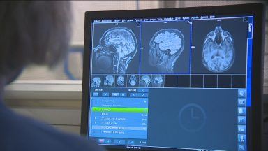 ‘Devastating blow’ as dementia drug rejected by NHS Scotland