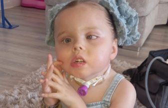 Five-year-old from Glasgow with rare brain tumour raising funds for bespoke tricycle 