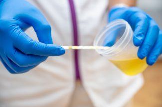 ‘Stop sending unsolicited urine samples’, says GP