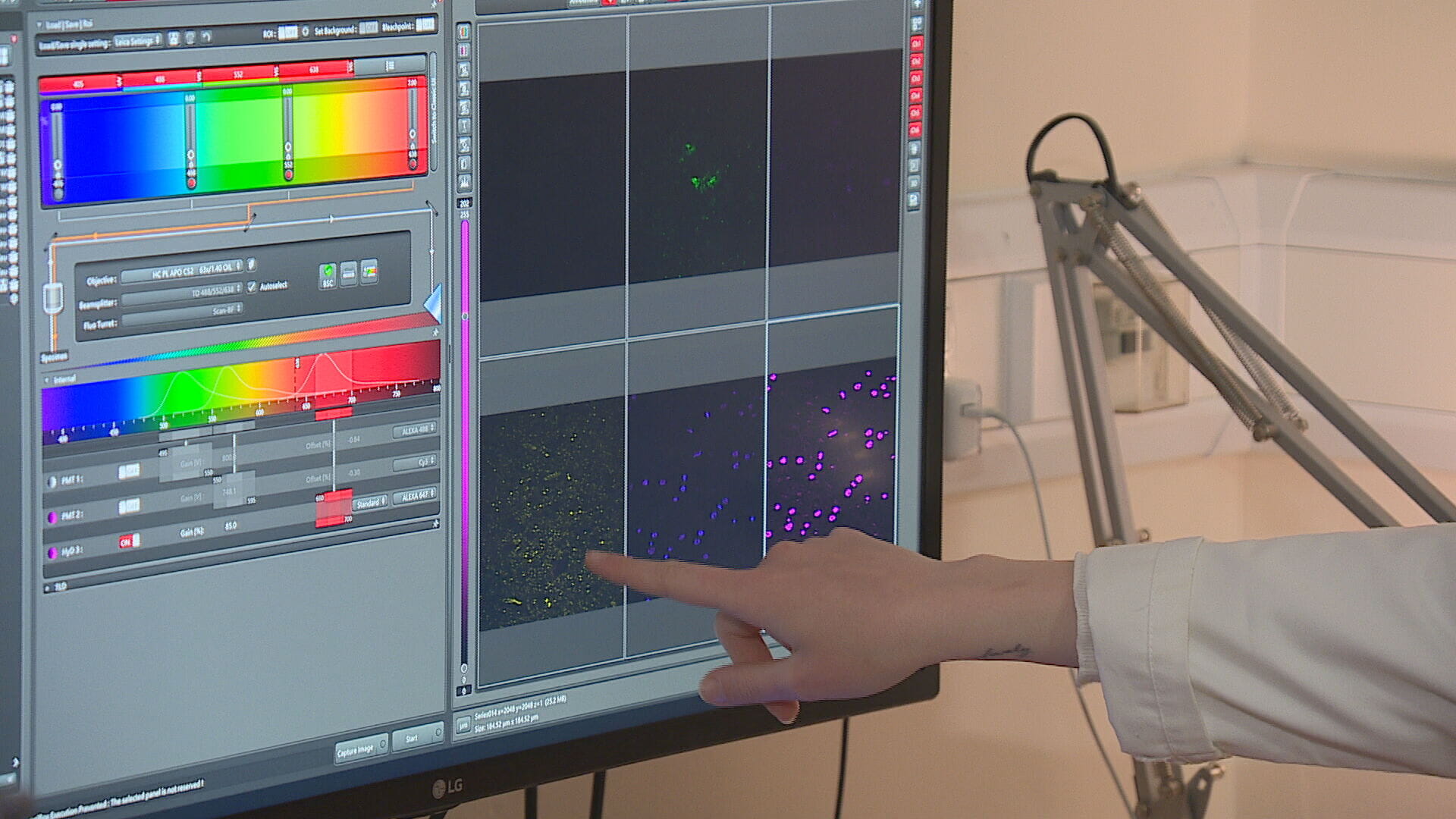 Scientists in Edinburgh believe they may be on the cusp of a breakthrough.