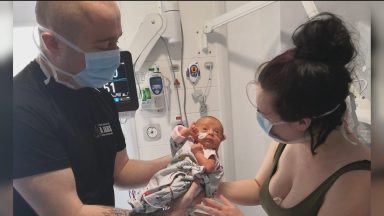 Milestone for girl who contracted Covid at three months old