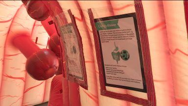 Campaign urges more awareness into the signs of bowel cancer
