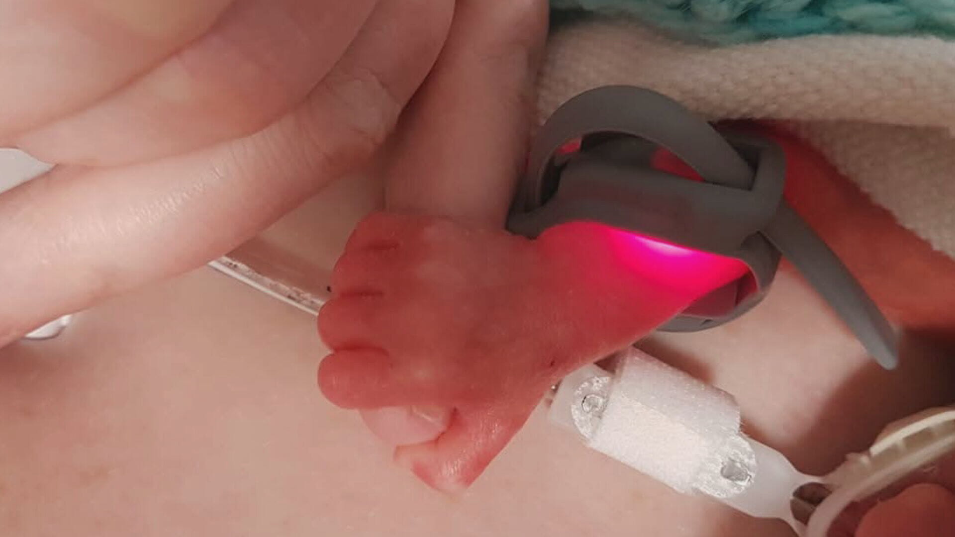 Little Innes could fit in the palm of his mum Lynne's hand