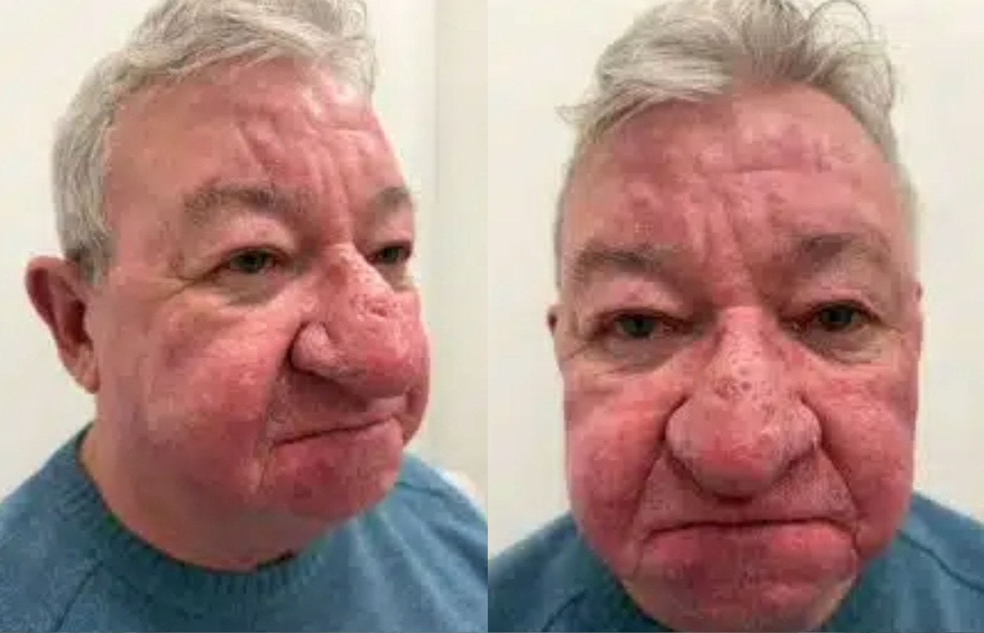 After: Gerard said his life has been 'totally turned around'.