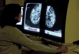 Charity slams ‘deeply unfair’ move to reject breast cancer treatment for Scots