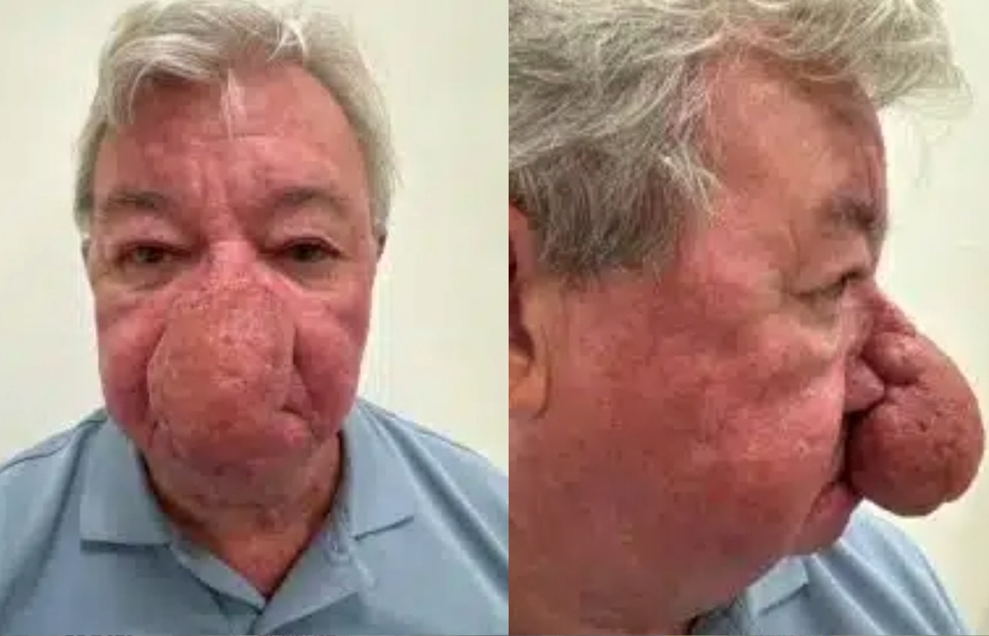Before: Gerard said he tried to ignore the condition.