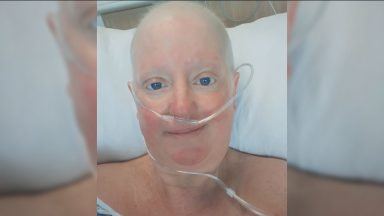 Campaigners call for secondary breast cancer cases to be recorded