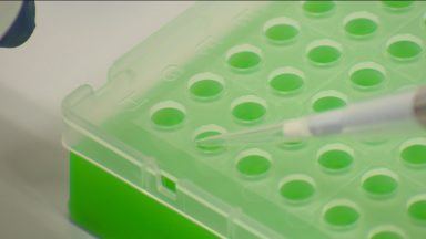 Scots scientists find way to test people for stroke medication resistance