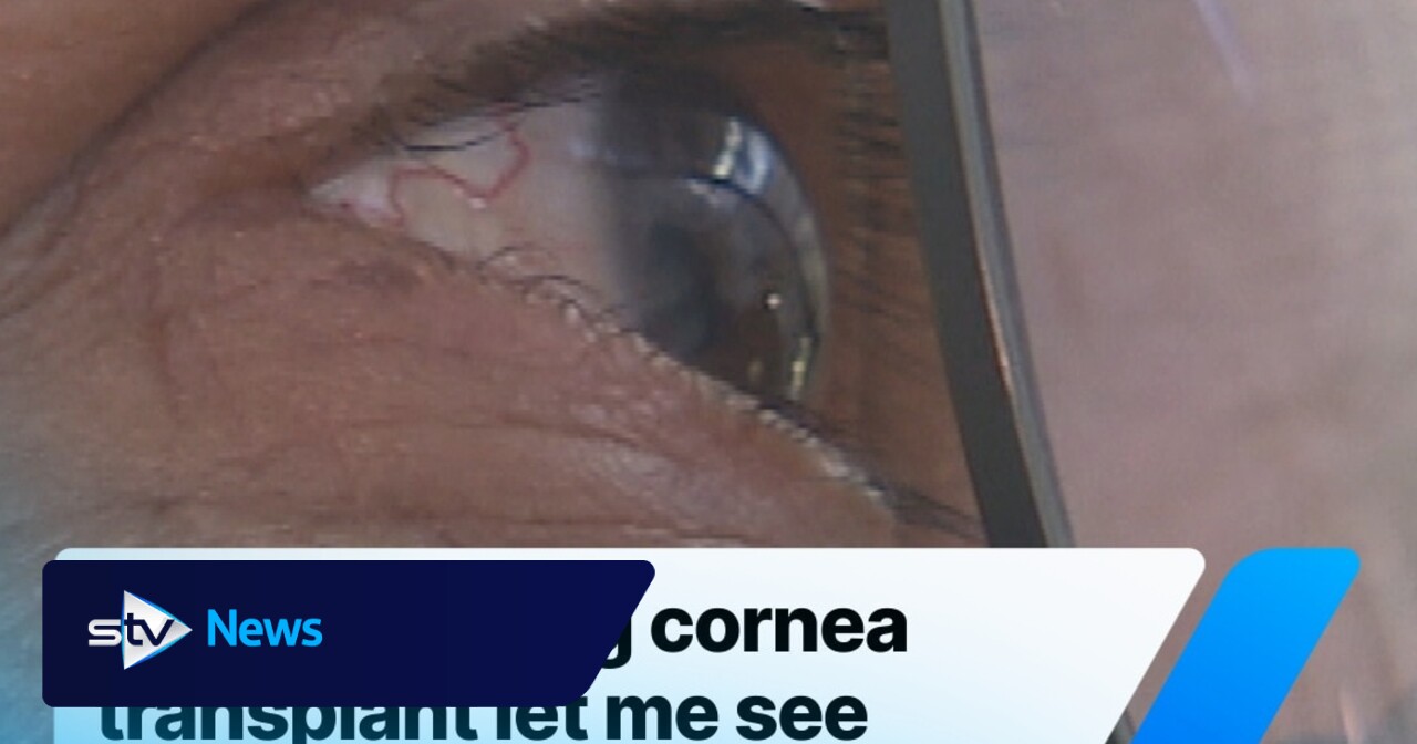 ‘I saw the world through a foggy screen – then a transplant brought back colour'