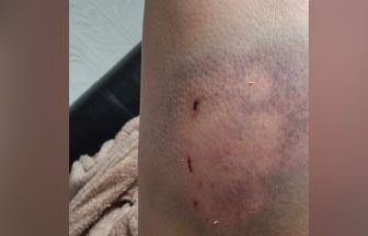 Person ‘attacked’ by two large dogs in Glasgow as police launch investigation