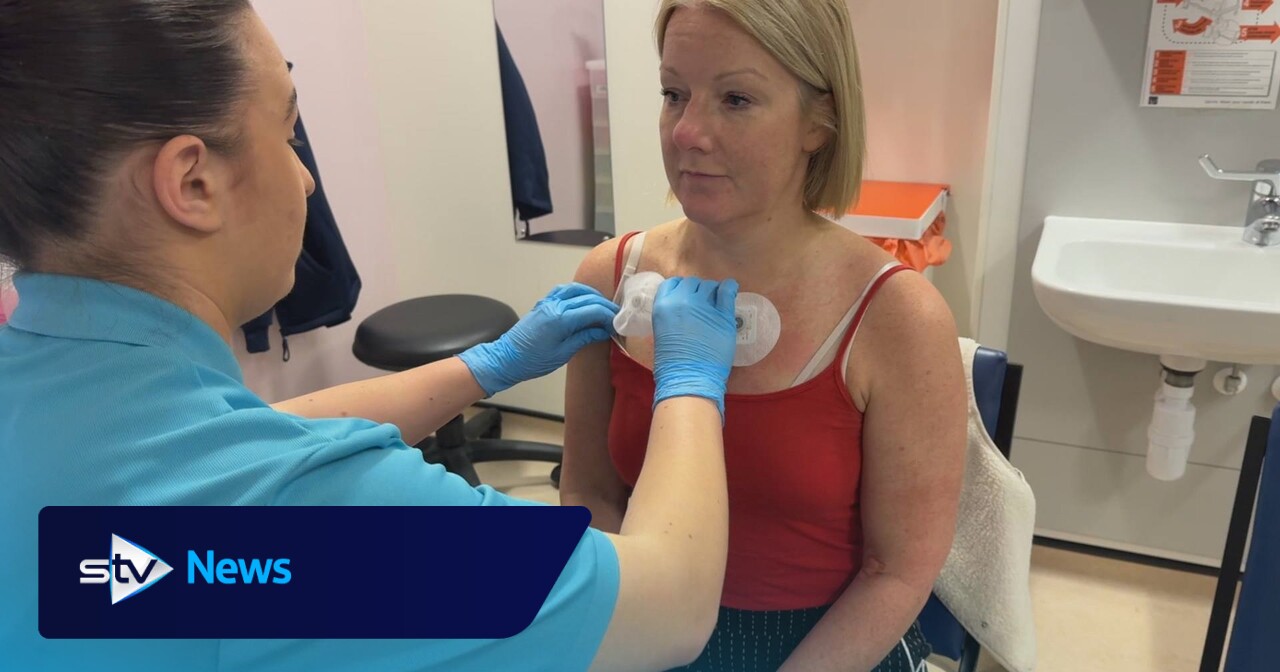 NHS ‘patch and go’ heart monitor to cut year-long ECG waits to just weeks