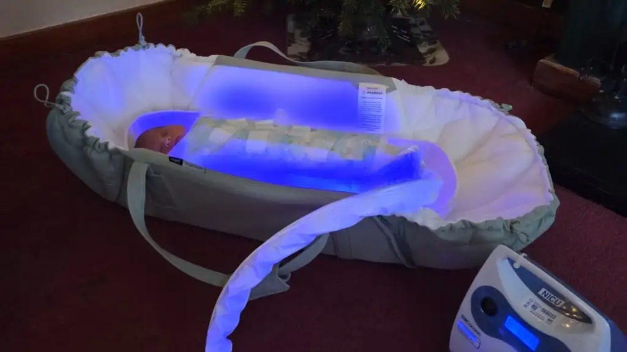 Newborns with jaundice treated at home in sleeping bag-style garment