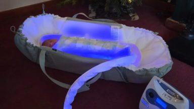 Newborns with jaundice treated at home in sleeping bag-style garment