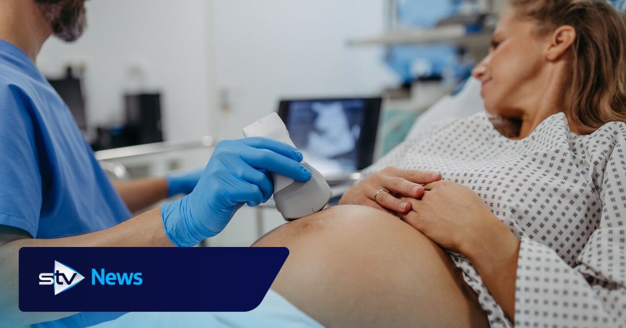 Safety concerns raised over high street private pregnancy scans | STV News