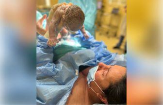 Mum lifts baby from womb during c-section in ‘first of its kind’ birth in Scotland