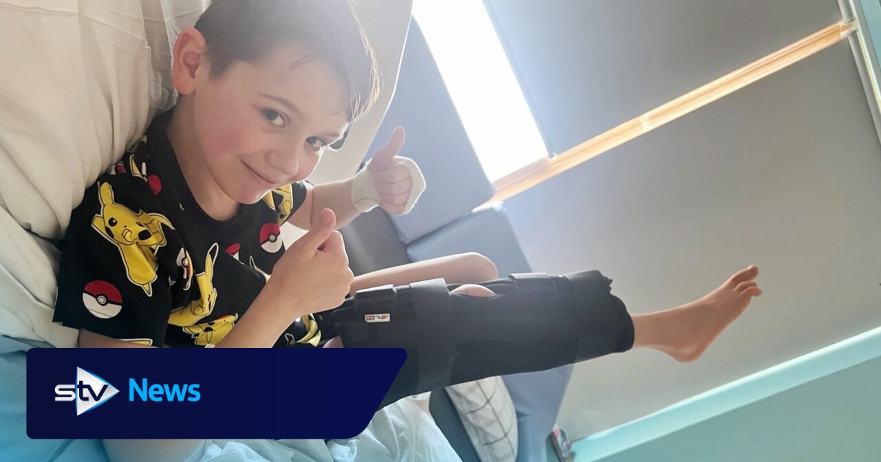 Nine-year-old boy first in UK to have innovative leg lengthening procedure