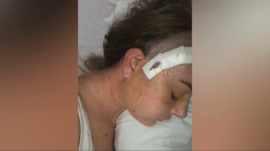 Fife woman links brain tumours to contraceptive injection