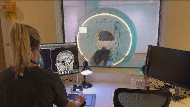 Full Body Scans: Revolutionising Healthcare or Raising Anxiety?