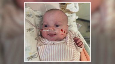 Premature Aberdeen baby first in Scotland for keyhole heart surgery