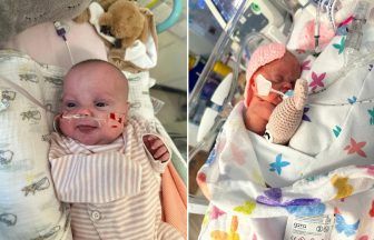 ‘Extremely premature’ Scots baby home after receiving new heart procedure