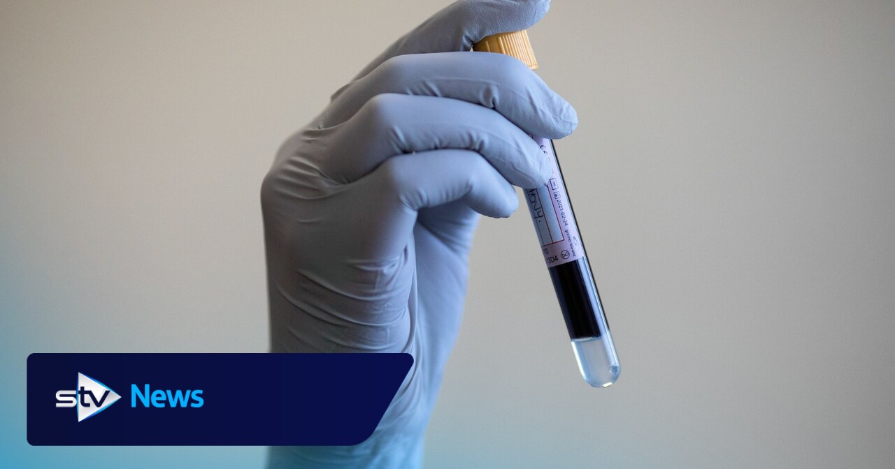 Large proportion of diabetics may have undiagnosed heart failure ...
