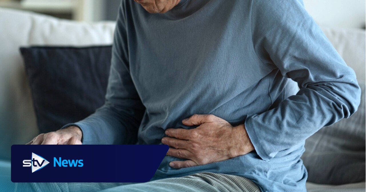 Scottish researchers lead major UK study aimed at improving bowel cancer prevention