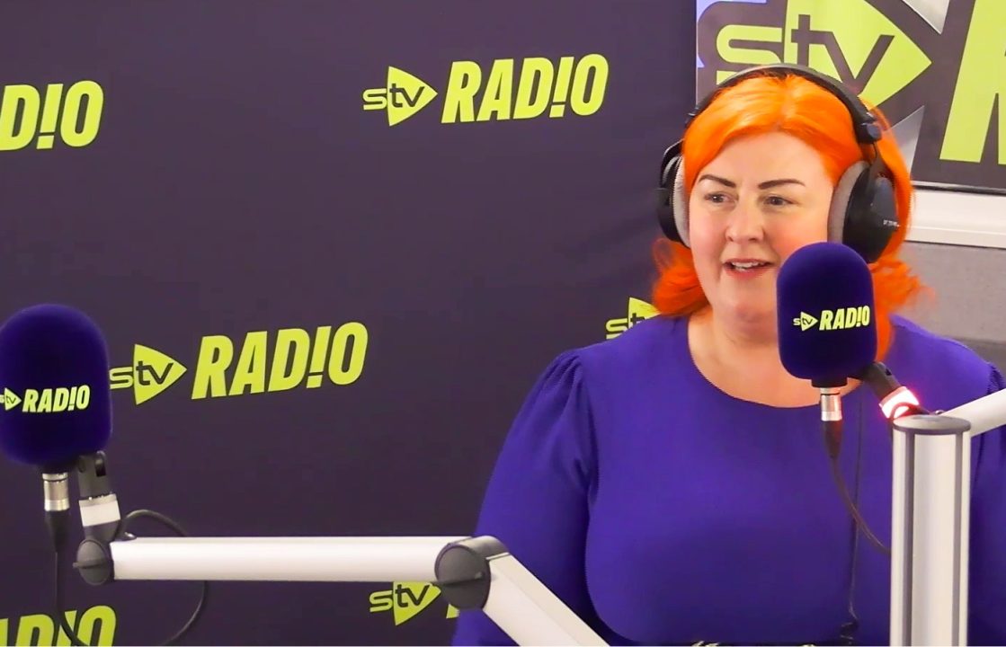 Michelle McManus ‘to start OnlyFans’ after varicose vein operation