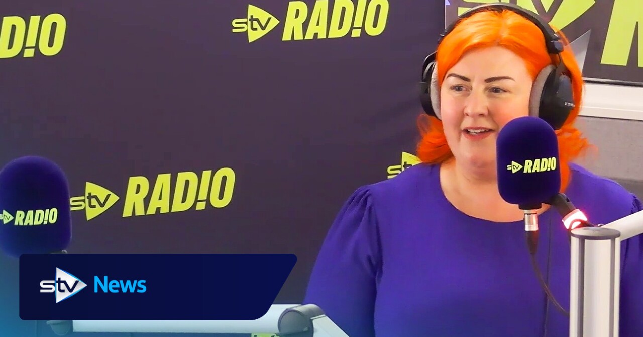 Michelle McManus ‘to start OnlyFans’ after varicose vein operation