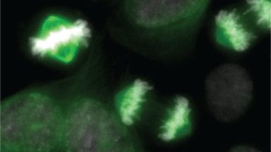 Study of cellular ‘light switches’ could spark new cancer treatments