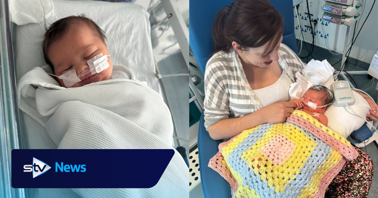 'Our baby had a stroke moments after birth - we're now celebrating her first birthday'