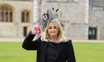Bonnie Tyler in induced coma after emergency intestinal surgery