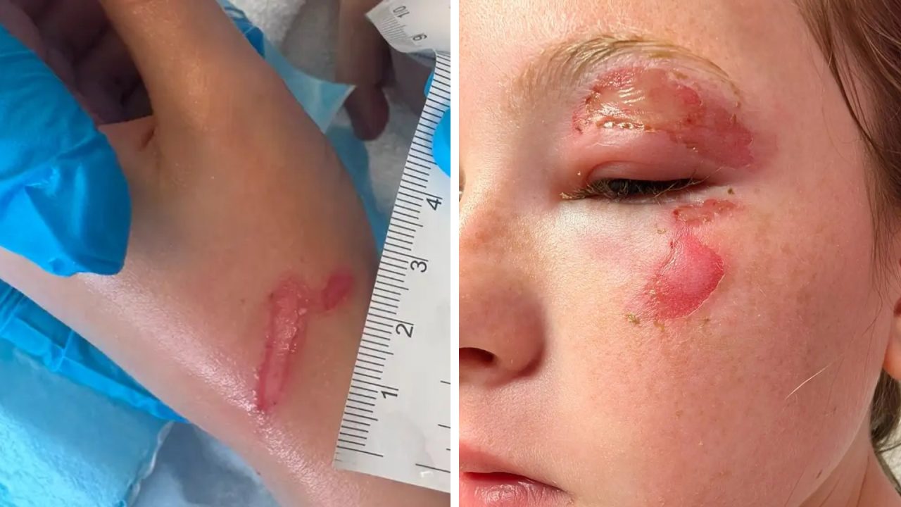 Warning as Scots children burned by exploding ‘squishy’ toys due to trend 